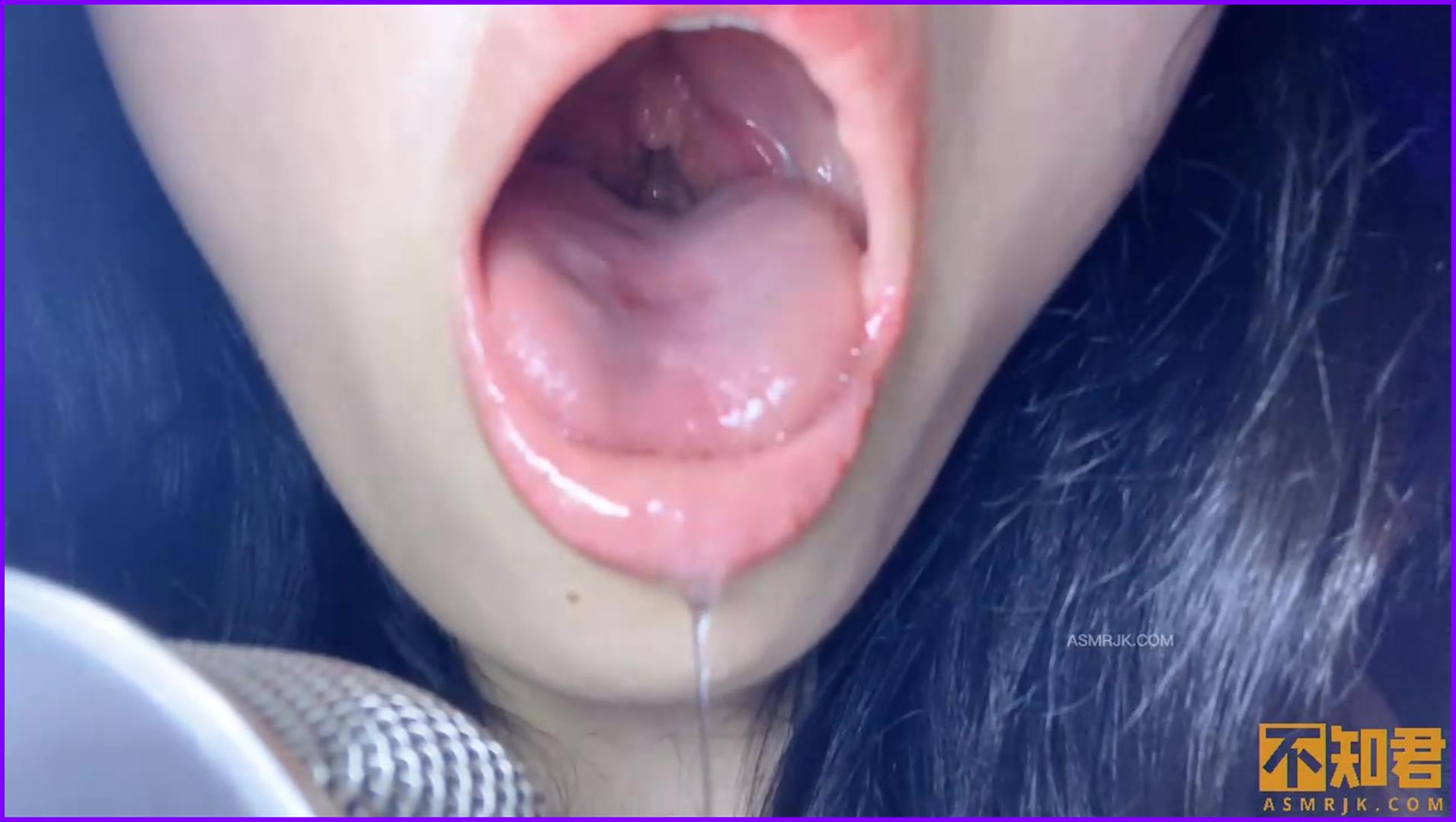 [小鹿大困包]检查深后